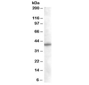 Western blot testing of Daudi lysate with SNX16 antibody at 0.05ug/ml. Predicted molecular weight: ~39kDa.