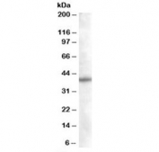 Western blot testing of Daudi lysate with SNX16 antibody at 0.05ug/ml. Predicted molecular weight: ~39 kDa.