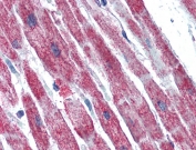 IHC testing of FFPE human heart tissue with SDHB antibody at 5ug/ml. Required HIER: steamed antigen retrieval with pH6 citrate buffer; AP-staining.