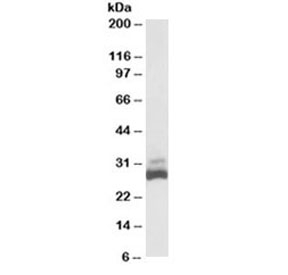 Western blot testing of human liver lysate with SDHB antibody at 0.03ug/ml. Predicted/observed molecular weight ~32/28kDa.~