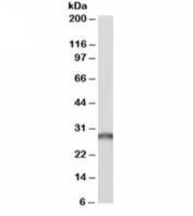 Western blot testing of human liver lysate with biotinylated SDHB antibody at 0.2ug/ml. Predicted/observed molecular weight ~32/28kDa. An NAP blocker was used in place of non-fat milk as blocking solution and diluent. (1)