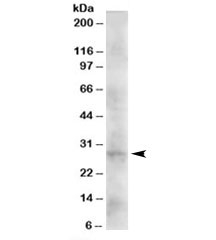 Western blot testing of human heart lysate with DKK2 antibody at 2ug/ml. Predicted molecular weight: ~28kDa.