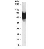 Western blot testing of human duodenum lysate with KLF4 antibody at 0.1ug/ml. Predicted molecular weight: 50-60 kDa + possible ~75 kDa (phosphorylated form).