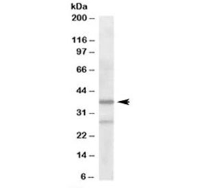 Western blot testing of human liver lysate with ARPC1B antibody at 2ug/ml. Predicted molecular weight: ~41kDa.~