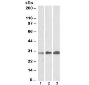 Western blot testing of human 1) thymus, 2) lymph node and 3) tonsil lysates with EFHD2 antibody at 0.5ug/ml. Predicted molecular weight: ~27 kDa.