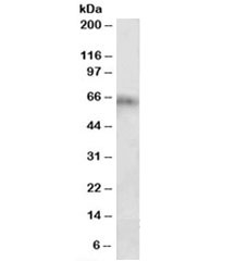Western blot testing of rat spleen lysate with Cyp2d5 antibody at 2ug/ml. Predicted molecular weight: ~57kDa, observed here at ~65kDa.