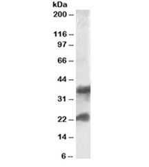 Western blot testing of human frontal cortex lysate with Clatherin Light Chain antibody at 0.1ug/ml. The expected molecular weight is 17~27kDa. A ~35kDa band has also been reported (PMID: 10942733).~
