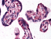 IHC testing of FFPE human placenta tissue with DKK1 antibody at 10ug/ml. Steamed antigen retrieval with citrate buffer pH 6, AP-staining.