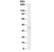 Western blot testing of human bone marrow lysate with DKK1 antibody at 1ug/ml. Predicted molecular weight: 26-40 kDa depending on glycosylation level.