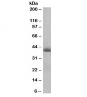 Western blot testing of human heart lysate with TIMM50 antibody at 0.5ug/ml. Predicted molecular weight: ~40/50/28kDa (isoforms 1/2/3).
