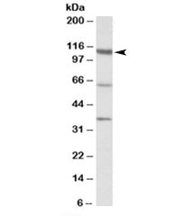 Western blot testing of human testis lysate with CP110 antibody at 1ug/ml. The expected ~110kDa band and the additional ~65/37kDa bands are all blocked by the immunizing peptide.