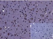 IHC testing of FFPE human brain (cortex) with LRRK2 antibody at 2ug/ml (negative control inset). Microwaved antigen retrieval with citrate buffer pH 6, HRP-staining.