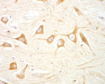 IHC testing of FFPE human hippocampus with LRRK2 antibody at 1.5ug/ml. Microwaved antigen retrieval with citrate buffer pH 6, HRP-staining.~