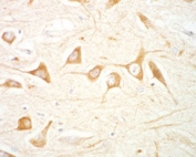 IHC testing of FFPE human hippocampus with LRRK2 antibody at 1.5ug/ml. Microwaved antigen retrieval with citrate buffer pH 6, HRP-staining.