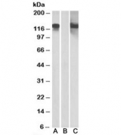 Western blot testing of HEK293 lysate overexpressing human CDH11 with MYC tag with CDH11 antibody [1ug/ml] in Lane A and probed with anti-MYC tag [1/1000] in lane C. Mock-transfected HEK293 probed with CDH11 antibody [1ug/ml] in Lane B. Predicted molecular weight: ~88kDa but can be observed at 120-130kDa.