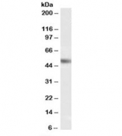 Western blot testing of human testis lysate with NR0B1 antibody at 0.5ug/ml. Predicted molecular weight: ~52kDa.