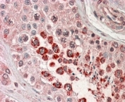 IHC testing of FFPE human testis with XAGE1 antibody at 4ug/ml. HIER: steamed with pH6 citrate buffer, AP-staining.