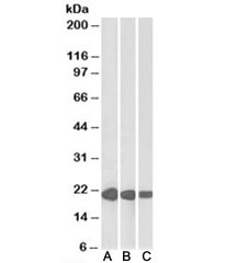 Western blot testing of human [A], mouse [B] and rat [C] heart lysate with CSRP3 antibody at 0.01ug/ml. Predicted molecular weight: ~21kDa.