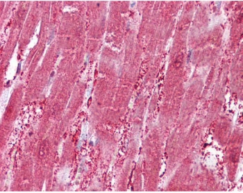 IHC testing of FFPE human heart tissue with CSRP3 antibody at 2.5ug/ml. Required HIER: steamed antigen retrieval with pH6 citrate buffer; AP-staining.