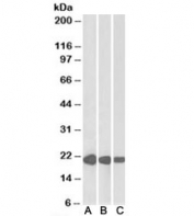 Western blot testing of human [A], mouse [B] and rat [C] heart lysate with CSRP3 antibody at 0.01ug/ml. Predicted molecular weight: ~21 kDa.