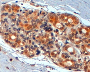 IHC staining of FFPE human breast with WNT3 antibody at 2ug/ml. HIER: steamed with pH6 citrate buffer, HRP-staining.