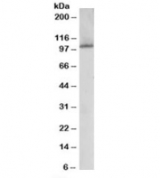 Western blot testing of human liver lysate with JIK antibody at 0.1ug/ml. Predicted molecular weight: ~105kDa.