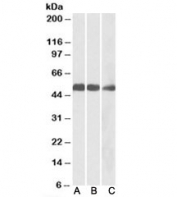 Western blot of mouse (A), rat (B) and pig (C) heart lysates with IDH2 antibody at 0.1ug/ml. Predicted molecular weight: 45-51 kDa (two isoforms).