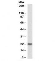 Western blot testing of human testis lysate with MRGBP antibody at 0.3ug/ml. Predicted molecular weight: ~22kDa.