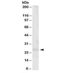 Western blot testing of human muscle lysate with Synaptogyrin 2 antibody at 0.3ug/ml. Predicted molecular weight: ~25kDa.