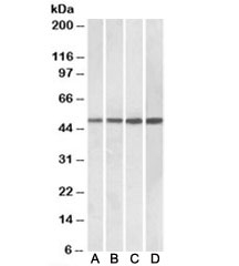 Western blot testing of Daudi [A], human tonsil [B], human spleen [C] and mouse spleen [D] lysates with BEND5 antibody at 0.3ug/ml. Predicted molecular weight: ~48kDa.