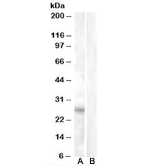 Western blot testing of heart lysate with RASSF3 antibody at 0.5ug/ml with [B] and without [A] immunizing/blocking peptide. Predicted molecular weight: ~27kDa.