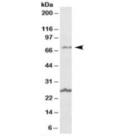 Western blot testing of human olfactory bulb lysate with SLC6A12 antibody at 1ug/ml. The expected ~70kDa band and the additional ~27kDa band are both blocked by the immunizing peptide.