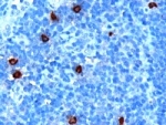 IHC staining of FFPE human tonsil with DOK5 antibody at 1ug/ml.  HIER: microwaved with pH6 citrate buffer, HRP-staining.