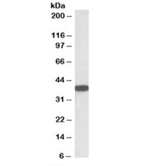 Western blot testing of human umbilical cord lysate with CYB5R3 antibody at 0.01ug/ml. Predicted molecular weight (human): ~34/32/38kDa (isoforms 1/2/3).~