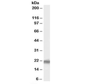 Western blot testing of human liver lysate with PERP antibody at 1ug/ml. Predicted molecular weight: ~21kDa.~