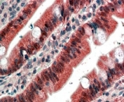 IHC staining of FFPE human small intestine with FGFR1 antibody at 4ug/ml. HIER: steamed with pH6 citrate buffer, AP-staining.