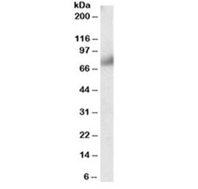 Western blot testing of human breast lysate with FGFR1 antibody at 0.3ug/ml. Predicted molecular weight of isoforms 1-4: 80~90kDa.