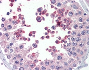 IHC testing of FFPE human testis with MLL4 antibody at 5ug/ml. HIER: steamed with pH6 citrate buffer, AP-staining.~