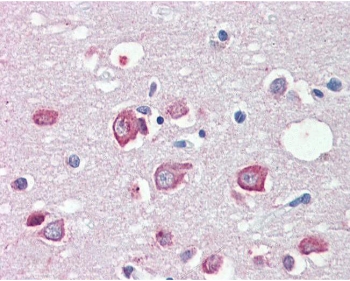 IHC testing of FFPE human brain (cortex) with MLL4 antibody at 5ug/ml. HIER: steamed with pH6 citrate buffer, AP-staini