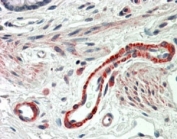 IHC testing of FFPE human colon with THBS3 antibody at 5ug/ml. HIER: steamed with pH6 citrate buffer, AP-staining.