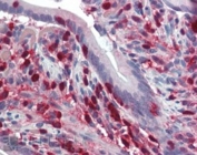 IHC staining of FFPE human small intestine with S100A4 antibody at 2.5ug/ml. HIER: steamed with pH6 citrate buffer, AP-staining.
