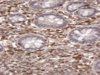 IHC staining of FFPE human small intestine lymphatic cells with S100A4 antibody at 2ug/ml. HIER: steamed with pH6 citrate buffer, HRP-staining.