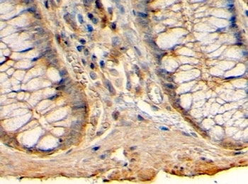 IHC testing of FFPE human colon with HRH1 antibody at 4ug/ml. HIER: steamed with pH6 citrate buffer, HRP-staining.~