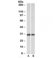 Western blot testing of human [A] and mouse [B] colon lysates with Galectin 3 antibody at 0.3ug/ml. Predicted molecular weight ~26kDa.