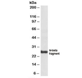 Western blot testing of human skin lysate with Pmel17 antibody at 1ug/ml. Predicted molecular weight: ~70/100/26kDa (unmodified/glycosylated/M-beta fragment).