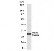 Western blot testing of human skin lysate with PMEL17 antibody at 1ug/ml. Predicted molecular weight: ~70/100/26 kDa (unmodified/glycosylated/M-beta fragment).