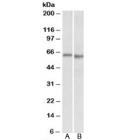Western blot of mouse (A) and rat (B) heart lysate with PRKAA2 antibody at 0.3ug/ml. Predicted molecular weight: ~62kDa.