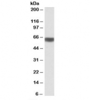 Western blot testing of human liver lysate with PRKAA2 antibody at 1ug/ml. Predicted molecular weight: ~62kDa.