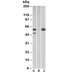 Western blot testing of HEK293 lysate overexpressing human TRIM21 with MYC tag with TRIM21 antibody [1ug/ml] in Lane A and probed with anti-MYC tag [1/1000] in lane C. Mock-transfected HEK293 probed with TRIM21 antibody [1ug/ml] in Lane B.