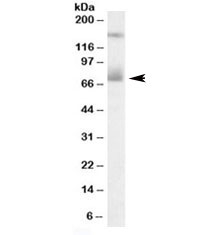 Western blot testing of human placenta lysate with Mesothelin antibody at 0.3ug/ml. The expected ~70kDa band and the additional ~150kDa band are both blocked by the immunizing peptide.